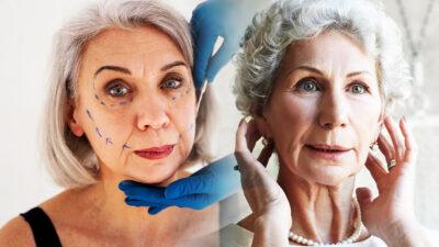 La chirurgie esthétique chez les seniors : un choix judicieux ?